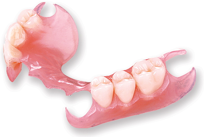 Prothèse dentaire avec attachement